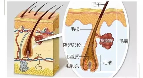 广州毛发种植手术成功的三大保障你知道吗​