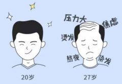 瑞士NAT美学植发是中国最好的技术吗