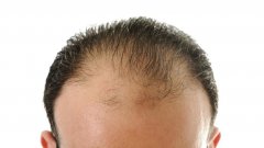 什么是周期性毛发养护？效果真的更好吗？